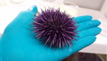 Purple-sea-urchin-in-gloved-hand